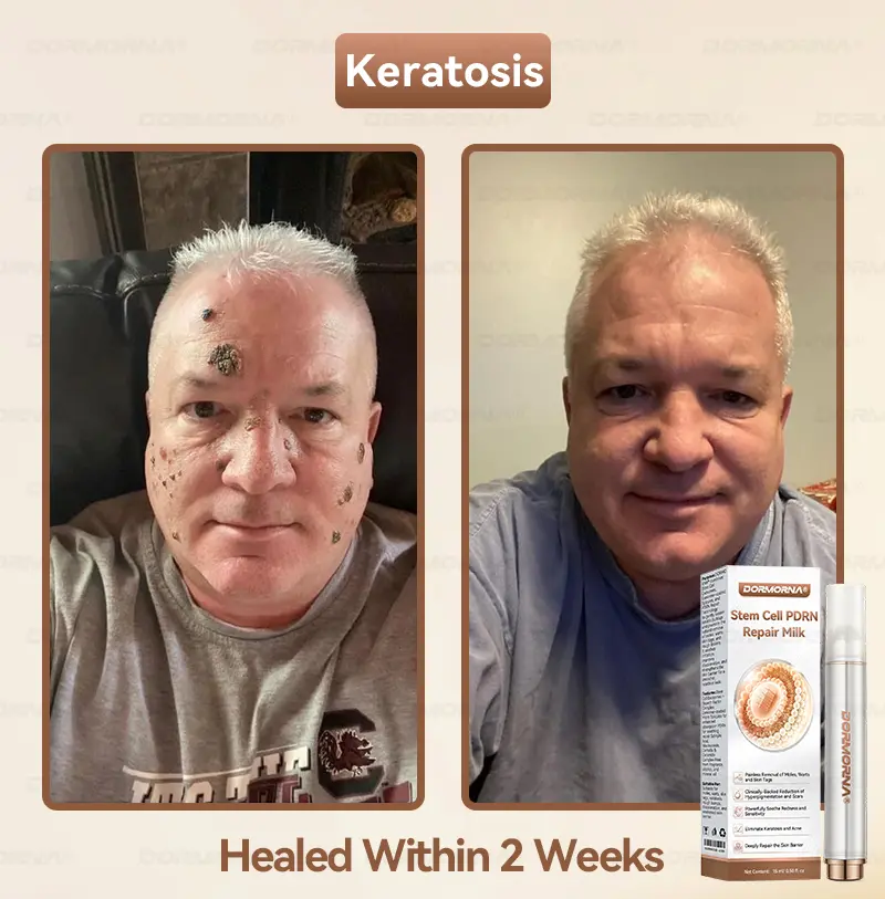 ๐๐ญ๐๐ฆ ๐๐๐ฅ๐ฅ ๐๐๐๐ ๐๐๐ฉ๐๐ข๐ซ ๐๐ข๐ฅ๐ค - Image 4