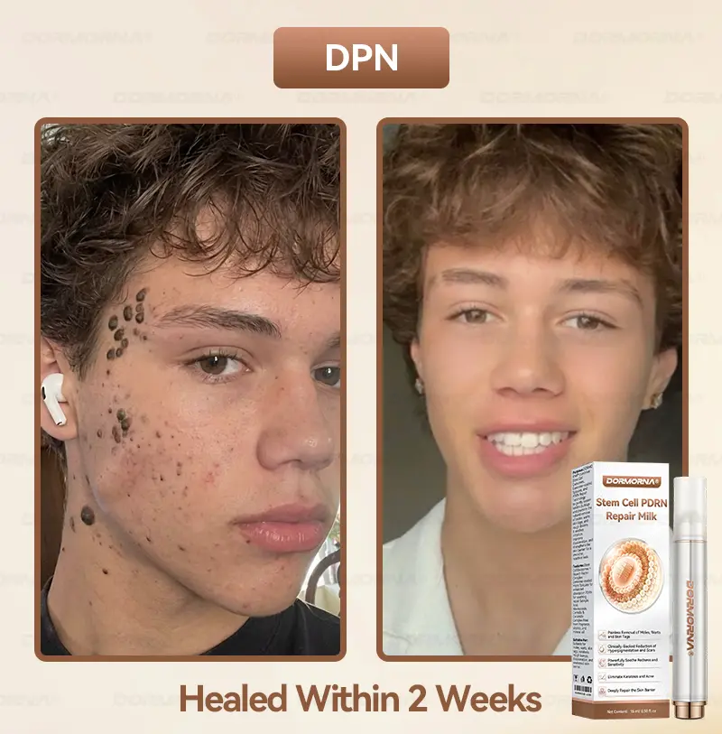 ๐๐ญ๐๐ฆ ๐๐๐ฅ๐ฅ ๐๐๐๐ ๐๐๐ฉ๐๐ข๐ซ ๐๐ข๐ฅ๐ค - Image 3