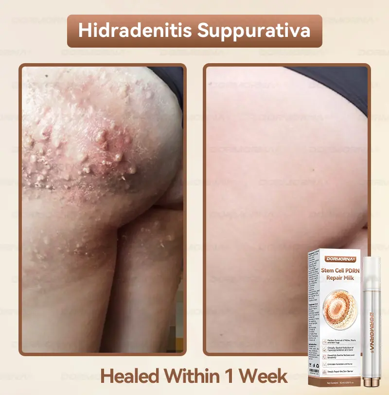 ๐๐ญ๐๐ฆ ๐๐๐ฅ๐ฅ ๐๐๐๐ ๐๐๐ฉ๐๐ข๐ซ ๐๐ข๐ฅ๐ค - Image 6