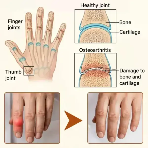 Joint Cream - Image 10