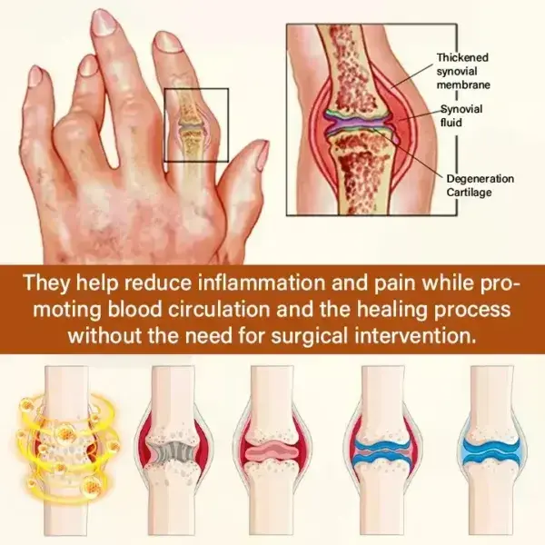Joint Cream - Image 9