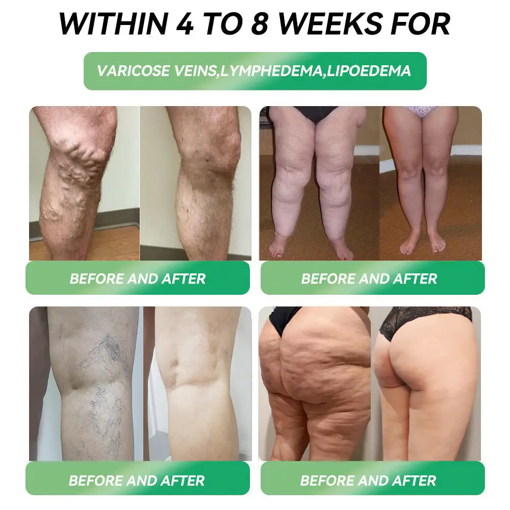 Telpotide Oral Solution - Image 3