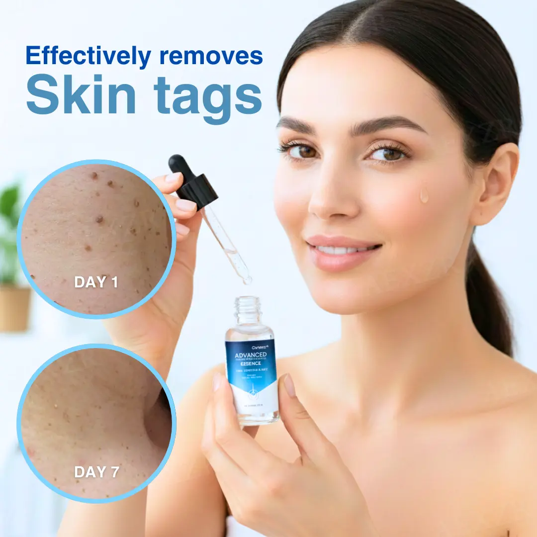Advanced Skin Tag & Wart Removal Essence - Image 5