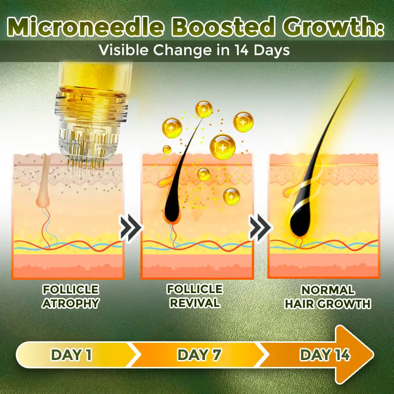 Microneedle Herbal Infusion Hair Stimulation Set - Image 4