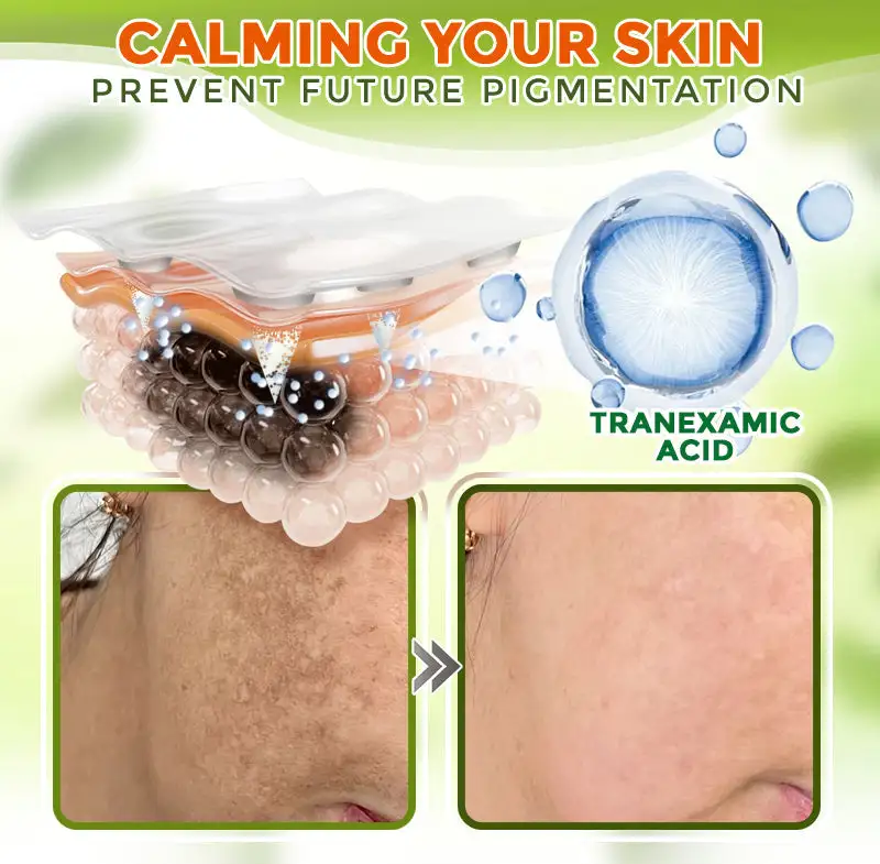 Comprehensive Microneedle Patch - Image 5