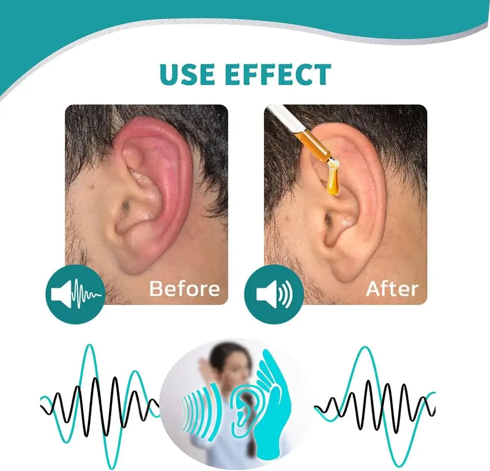 Ear Care Drops - Image 4