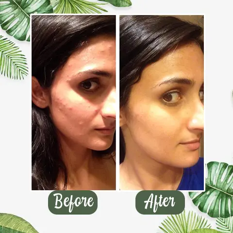 Green Tea Deep Cleanse Mask - Image 14