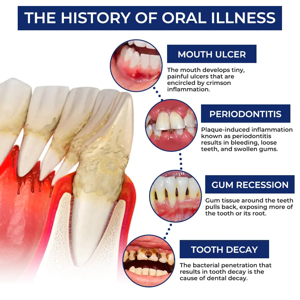 Bee Venom Dental Treatment Drops Mouthwash - Image 10