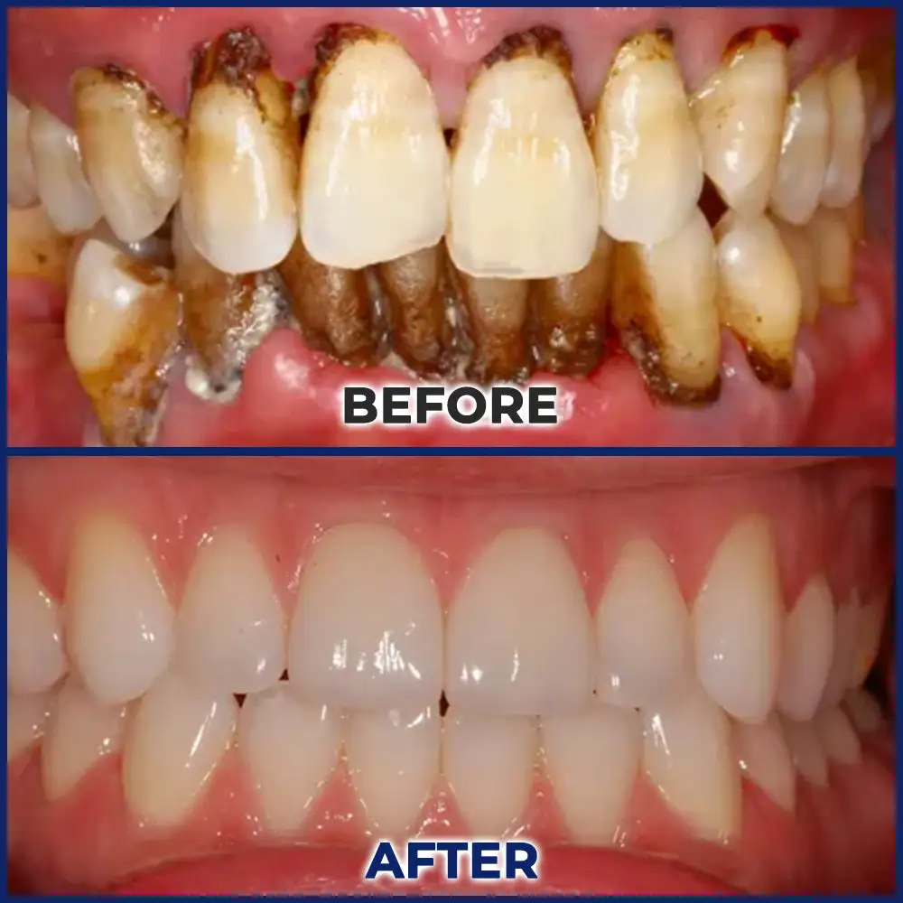 Bee Venom Dental Treatment Drops Mouthwash - Image 11