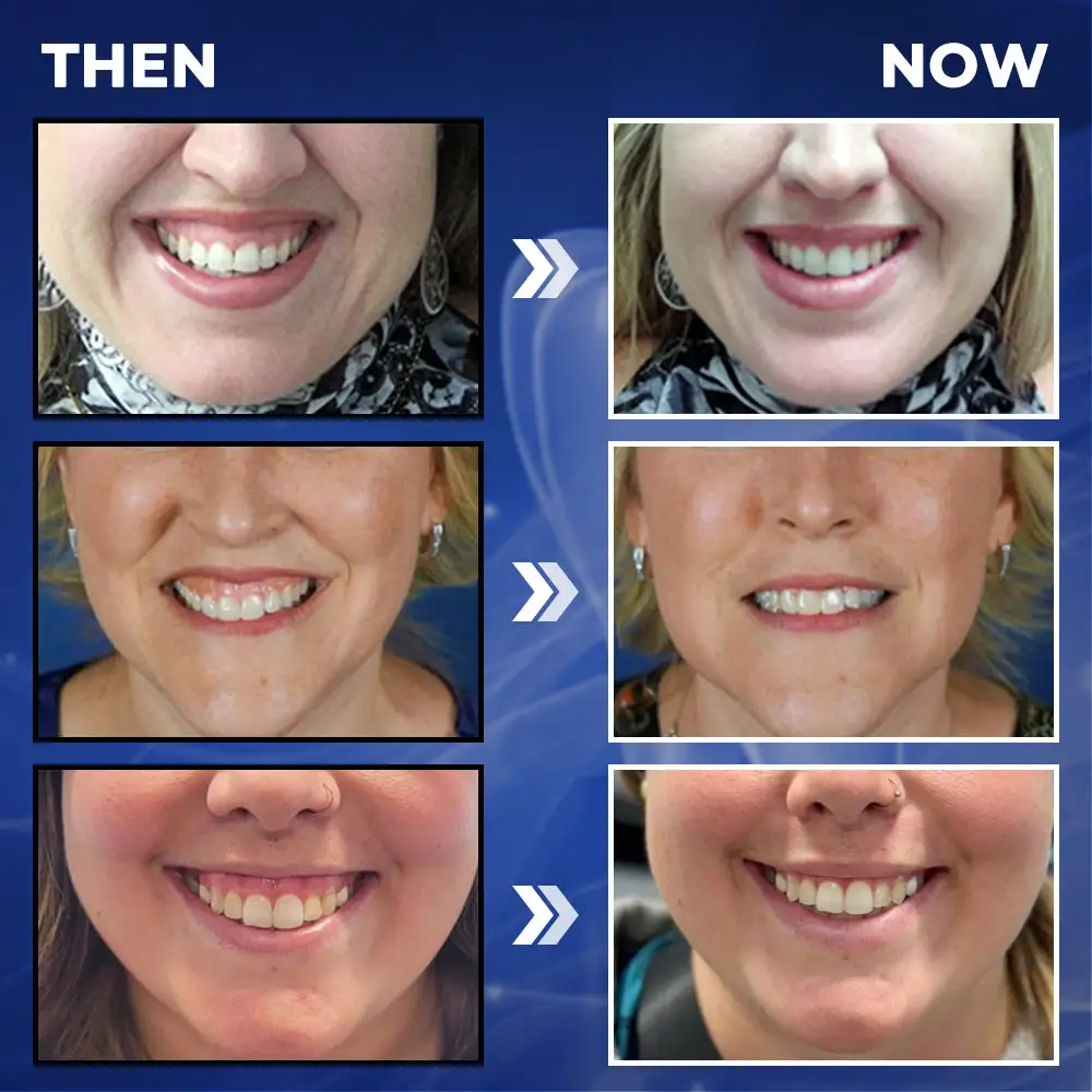 Bee Venom Dental Treatment Drops Mouthwash - Image 9