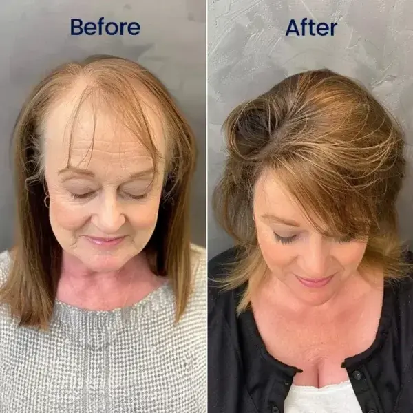 Maximum Strength 5% Minoxidil Fast-Action Hair Growth Serum - Image 11