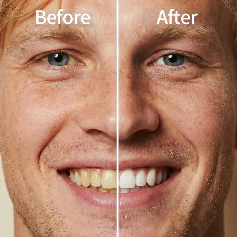 Instantly Whiter Smile🦷 - Image 2
