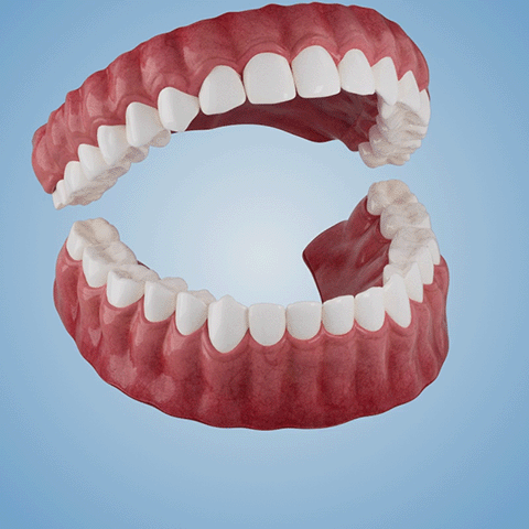Functional Dentures - Image 14