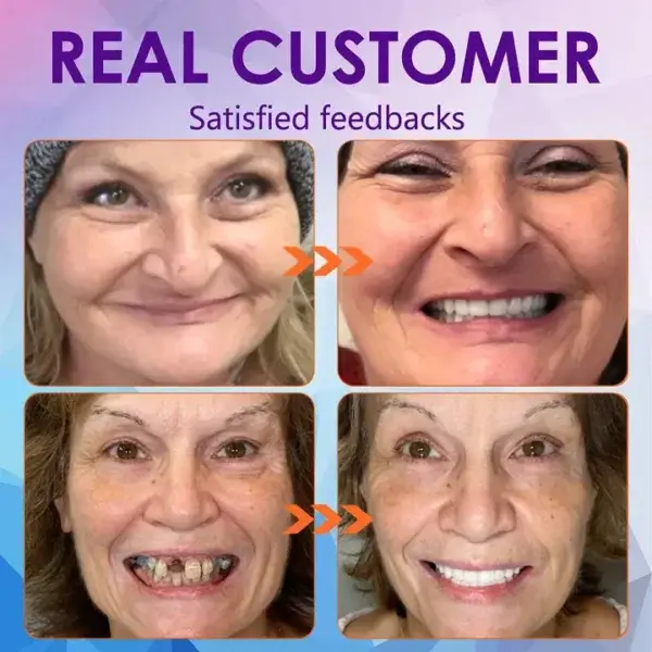 Functional Dentures - Image 6