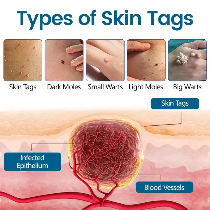 Precision Removal Cream - Image 7