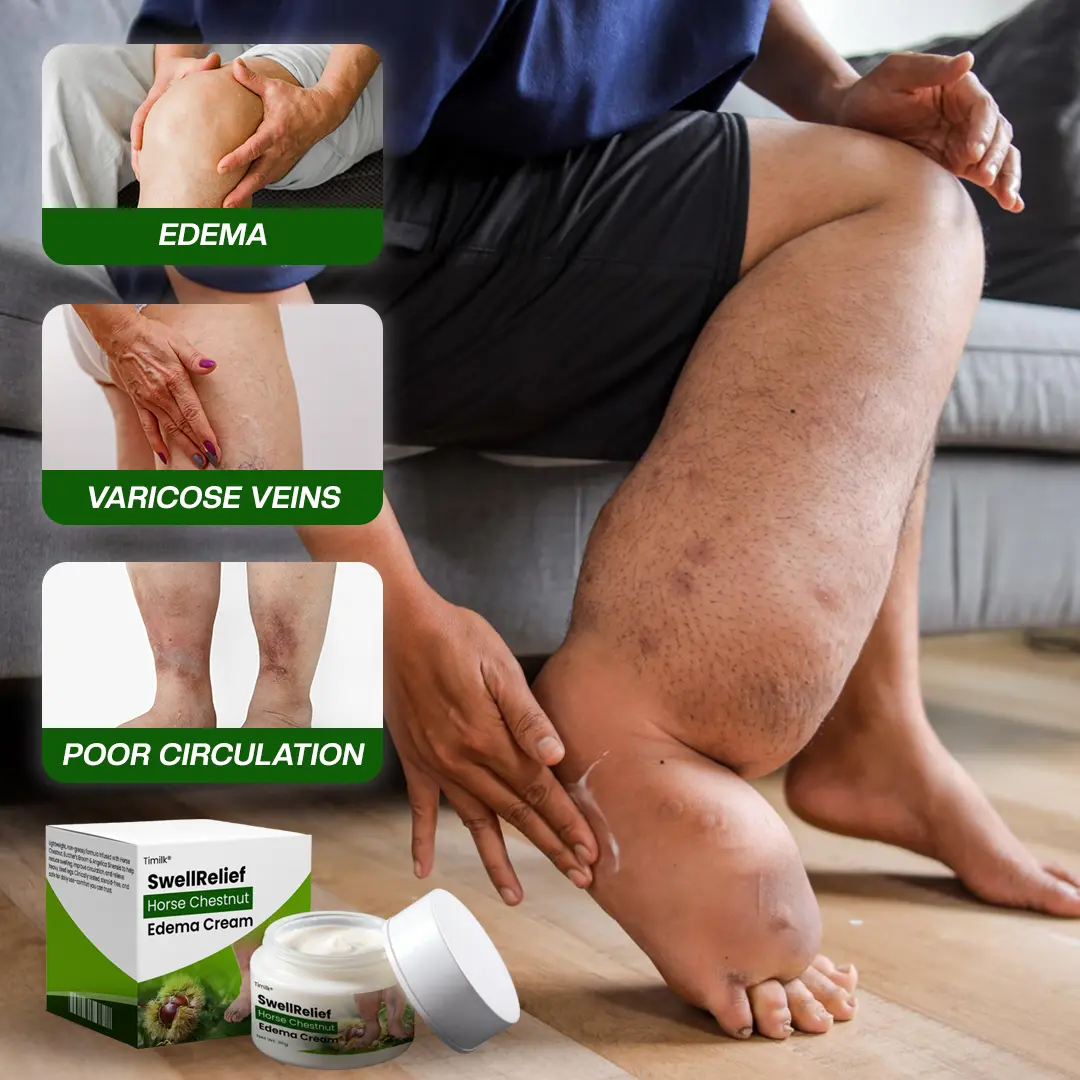 Horse Chestnut Edema Cream - Image 6