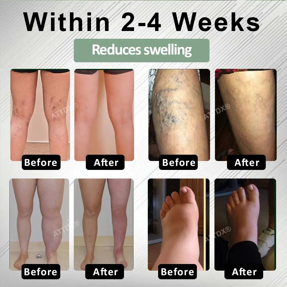 FlowBoost Edema Drain Herbal Roll On - Image 6