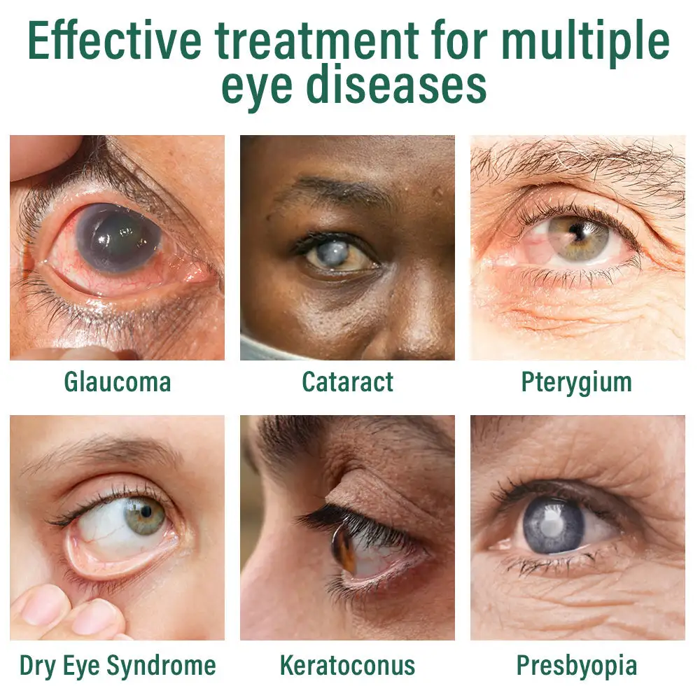 Nano Eye Drops Serum ✅FDA Approved(Suitable for presbyopia, dry eye syndrome, glaucoma, and cataracts) 🌷 - Image 11