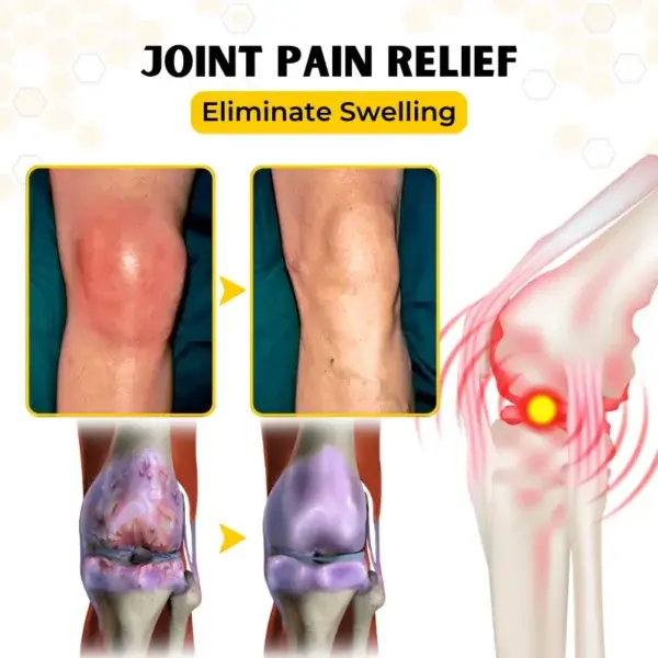 OrthoRestore Bee Venom Joint Relief Cream - Image 5