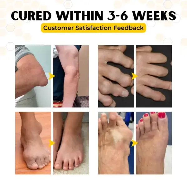 OrthoRestore Bee Venom Joint Relief Cream - Image 7