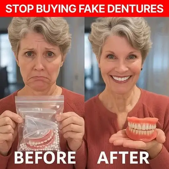 Custom-Fit Full Functional Dentures - Image 3