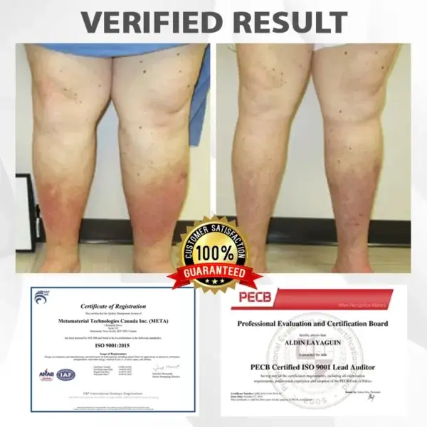 EdemaRelief Lymphatic Detox Cream - Image 5