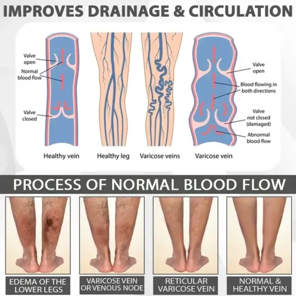 EdemaRelief Lymphatic Detox Cream - Image 6