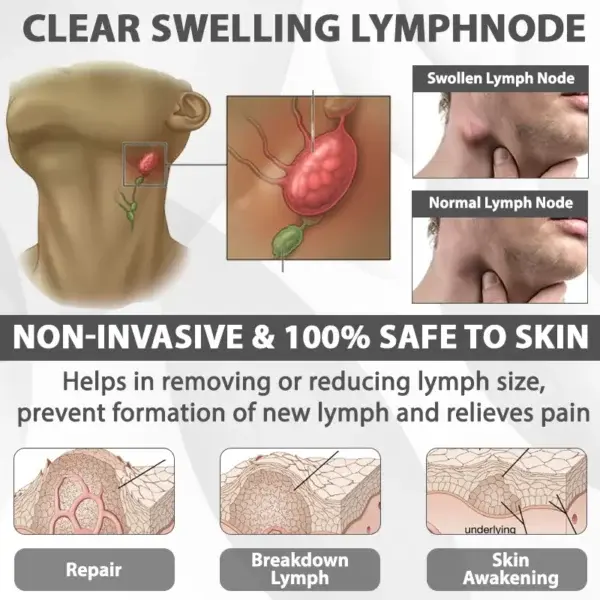 EdemaRelief Lymphatic Detox Cream - Image 7