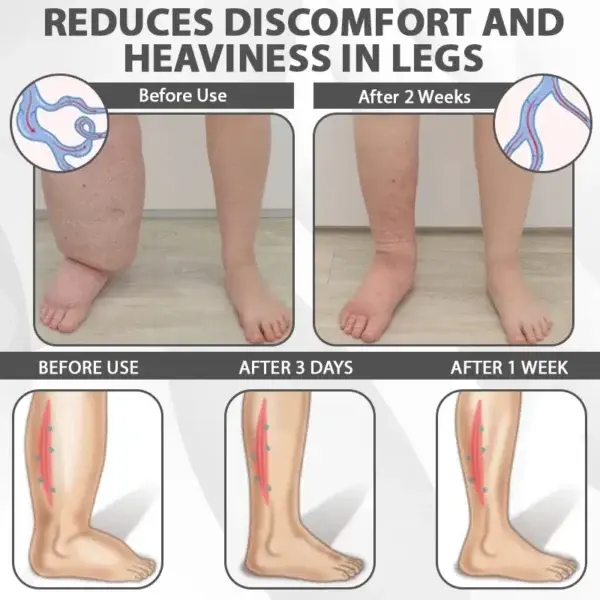 EdemaRelief Lymphatic Detox Cream - Image 8