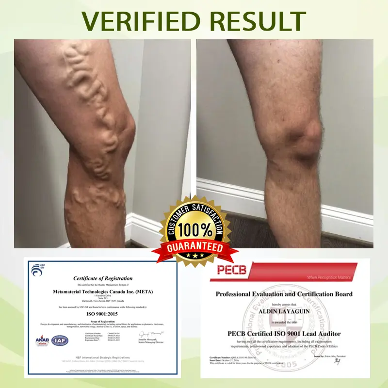 SwellFree Lymphatic Herbal Cream - Image 4