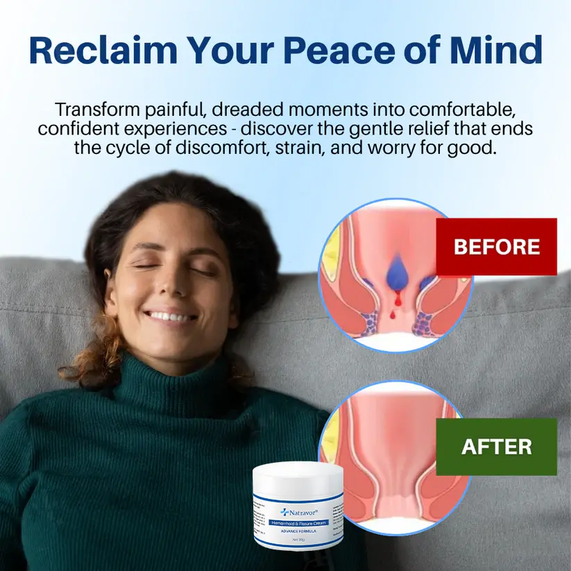 𝗛𝗲𝗺𝗼𝗿𝗿𝗵𝗼𝗶𝗱 & 𝗙𝗶𝘀𝘀𝘂𝗿𝗲 𝗖𝗿𝗲𝗮𝗺 - Image 3