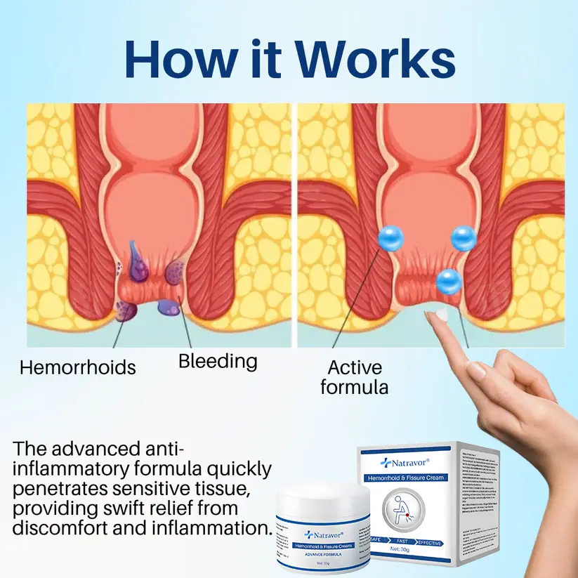 𝗛𝗲𝗺𝗼𝗿𝗿𝗵𝗼𝗶𝗱 & 𝗙𝗶𝘀𝘀𝘂𝗿𝗲 𝗖𝗿𝗲𝗮𝗺 - Image 5