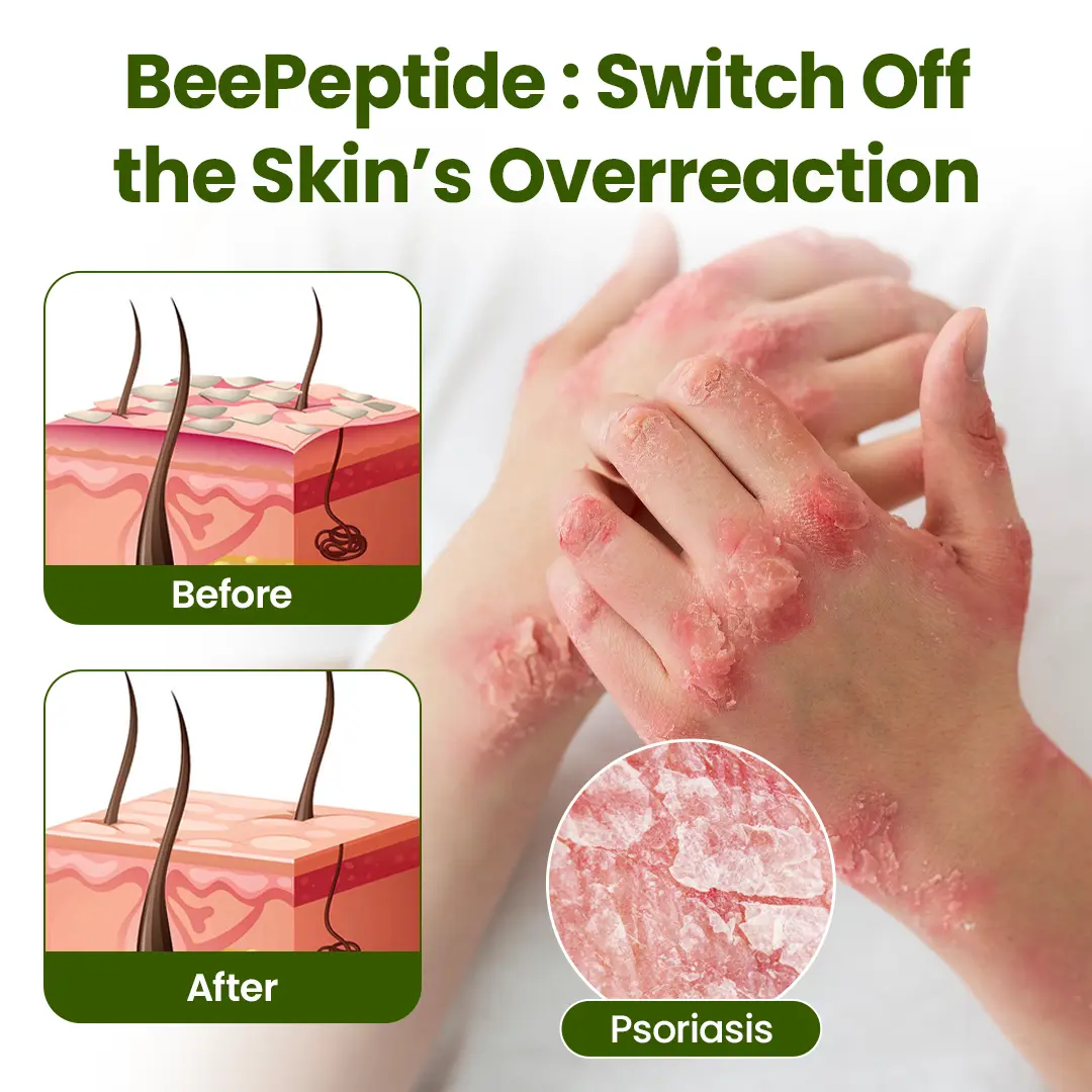 BeePeptide RootSoft DualRelief Cream - Image 7