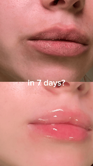 Peptide Nourishing Brightening Lip Serum - Image 2