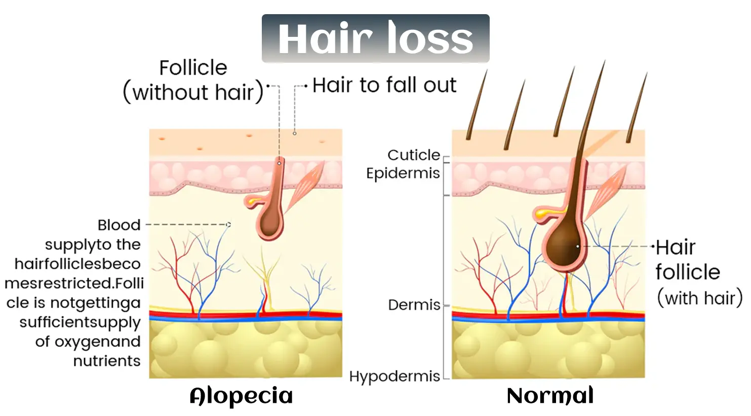 Biotin-Infused Hair & Beard Regrowth Atomizer -🔥7-Day Results - Image 7