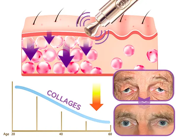 ✨RadianceEyes ✨ Pro-Vibrance Eye Cream Pen - Image 5