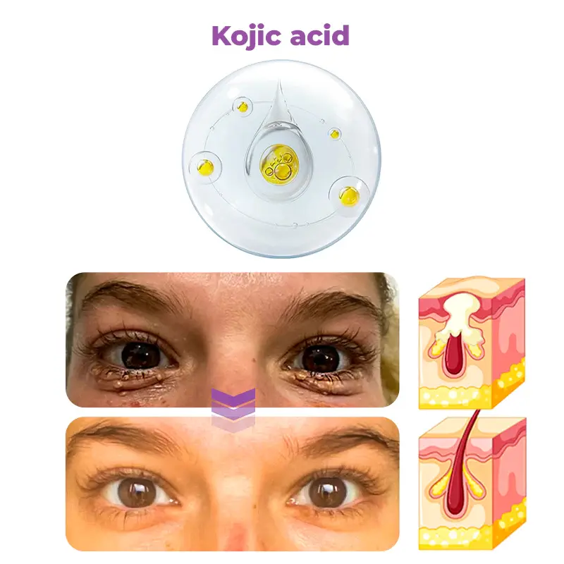 ✨RadianceEyes ✨ Pro-Vibrance Eye Cream Pen - Image 7