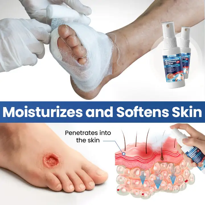 GlucoDerm Barrier Spray - Image 8