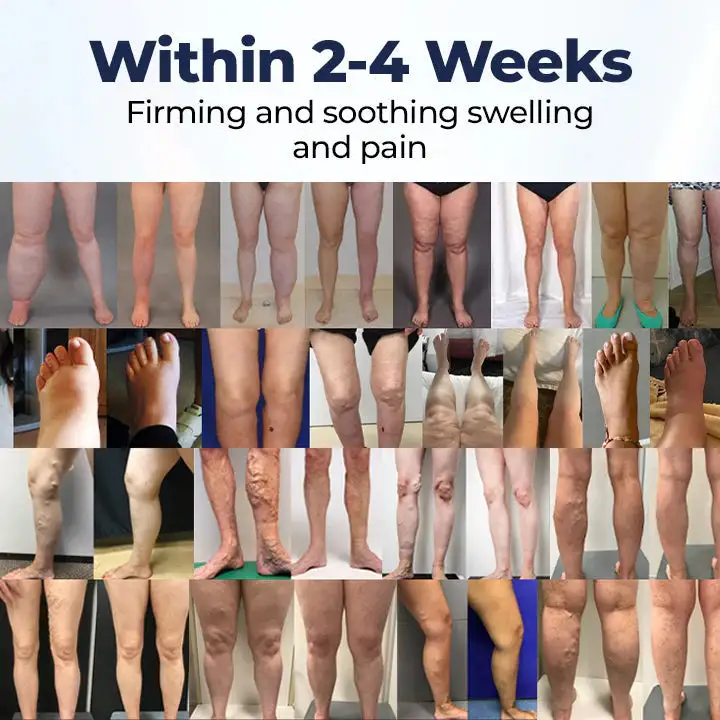 SwellRelief Circulation Support Cream - Image 5