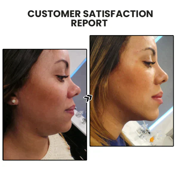 Lymphvity MagneTherapy Germanium Earrings - Image 7