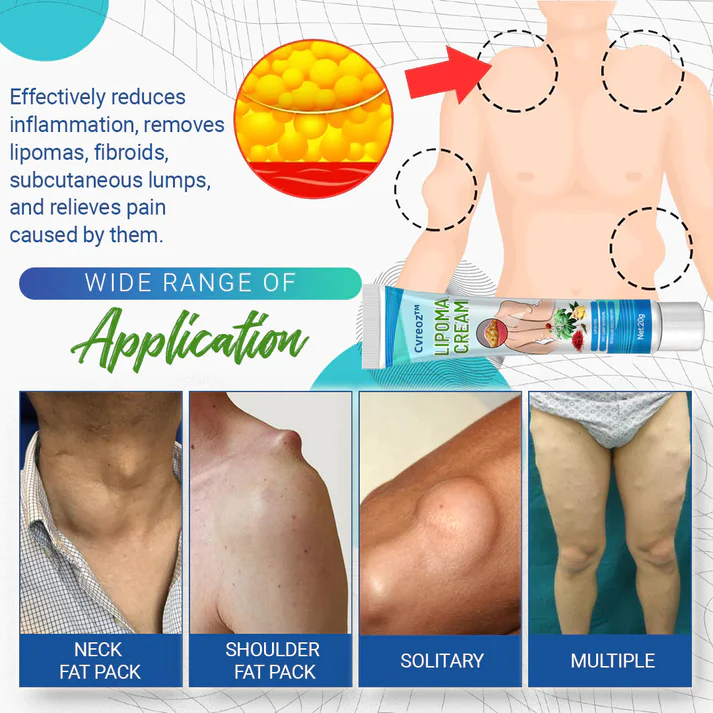 Lipoma Removal Cream - Image 10
