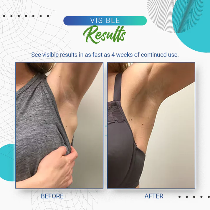 Lipoma Removal Cream - Image 8