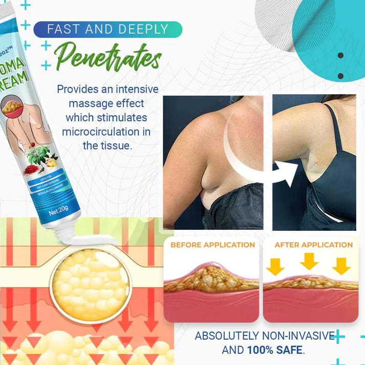 Lipoma Removal Cream - Image 9