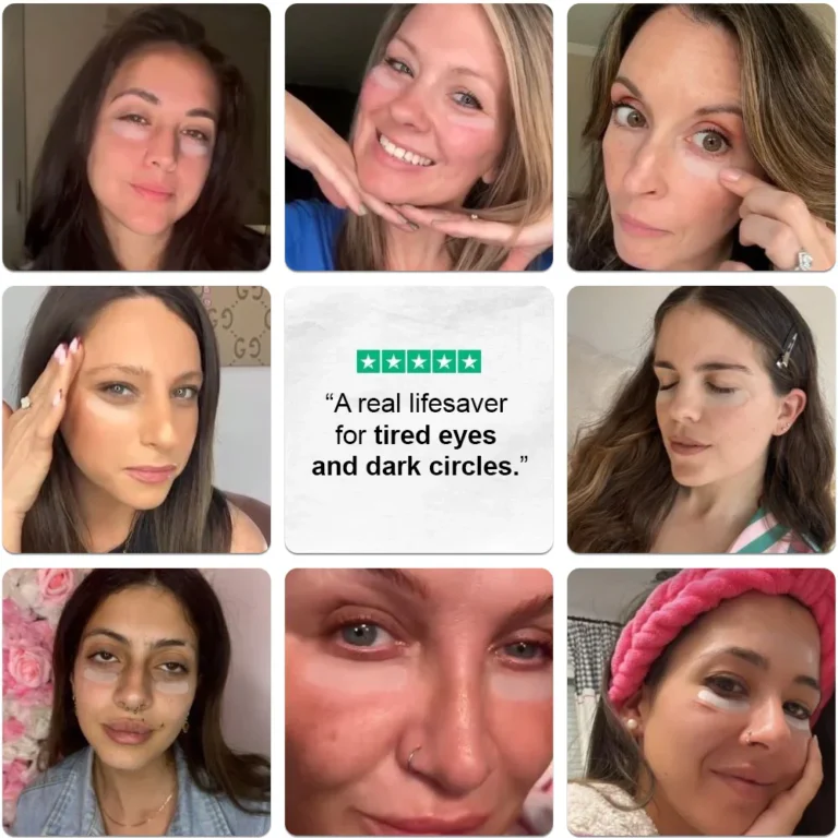 ✅Official Store: Deep Precision Age-Defying Nano Microneedle Patches – Deep-acting solution for tackling under-eye bags, dark circles, laughter lines, forehead lines, and all those other pesky facial wrinkles. - Image 5