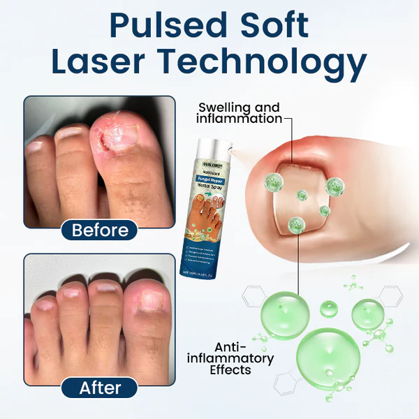 NailGuard Fungal Repair Herbal Spray - Image 8