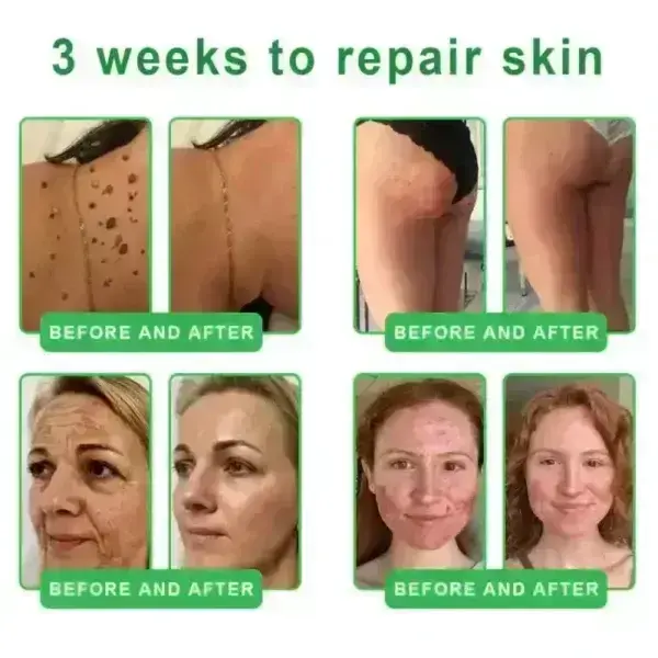 ๐๐๐+ ๐-๐ข๐ง-๐ ๐๐๐ซ๐ฆ๐๐๐๐ฉ๐๐ข๐ซ ๐๐๐ซ๐ฎ๐ฆ - Image 11