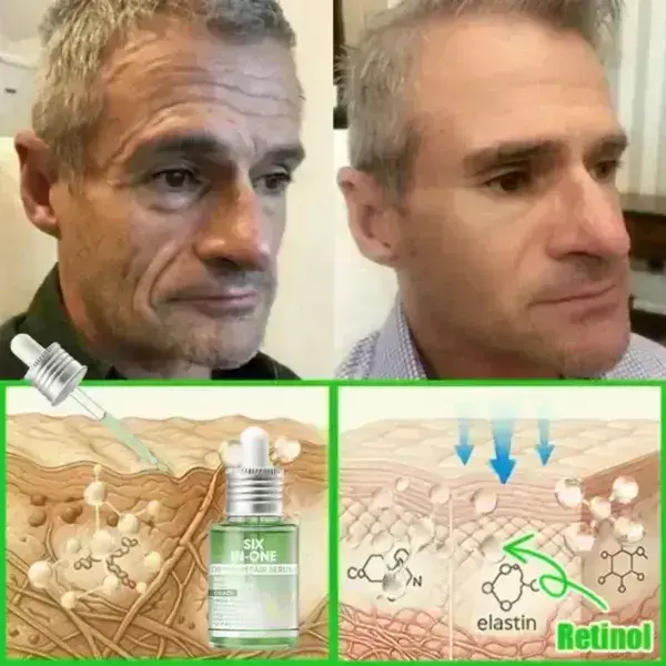 ๐๐๐+ ๐-๐ข๐ง-๐ ๐๐๐ซ๐ฆ๐๐๐๐ฉ๐๐ข๐ซ ๐๐๐ซ๐ฎ๐ฆ - Image 14