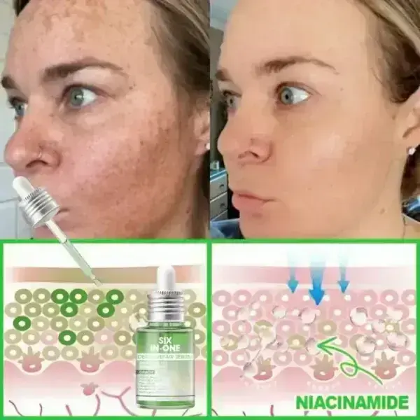 ๐๐๐+ ๐-๐ข๐ง-๐ ๐๐๐ซ๐ฆ๐๐๐๐ฉ๐๐ข๐ซ ๐๐๐ซ๐ฎ๐ฆ - Image 15