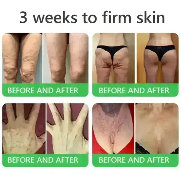 ๐๐๐+ ๐-๐ข๐ง-๐ ๐๐๐ซ๐ฆ๐๐๐๐ฉ๐๐ข๐ซ ๐๐๐ซ๐ฎ๐ฆ - Image 8