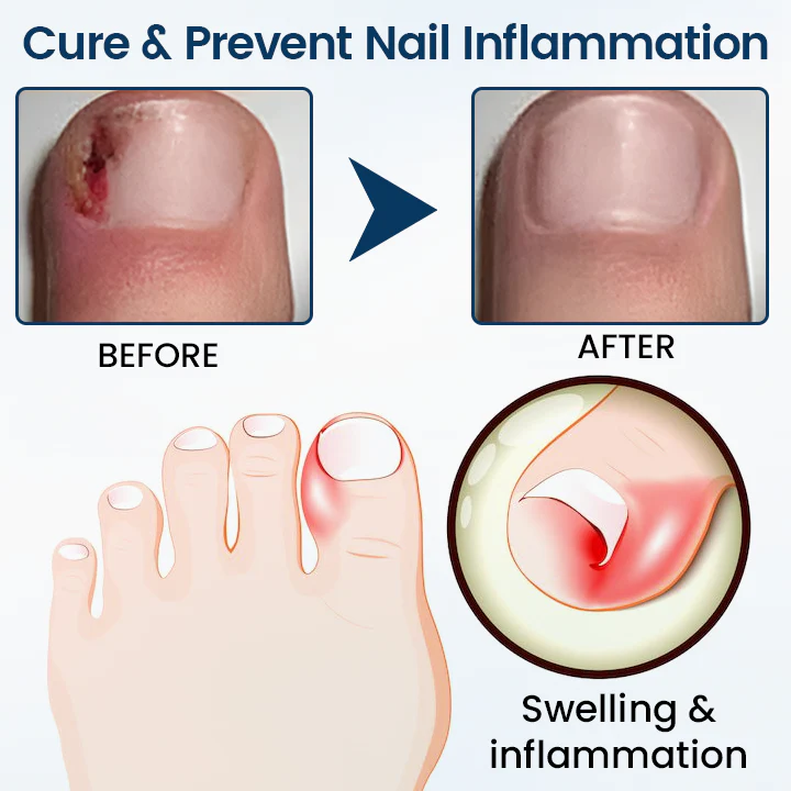 NailGuard Fungal Repair Herbal Spray - Image 7